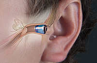 Mid-Kansas Ear, Nose & Throat: Hearing Aids - Invisible-In-The-Canal (IIC)